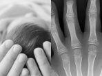 Bayi-di-India-lahir-dengan-26-kaki-dan-dianggap-sebagai-titisan-dewi.jpg