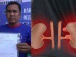 Erfin-Caleg-Bondowoso-Jual-Ginjal-untuk-Dana-Kampanye-Apakah-Jual-Beli-Organ-Tubuh-Dibolehkan.jpg