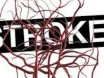 stroke_20181021_115344.jpg