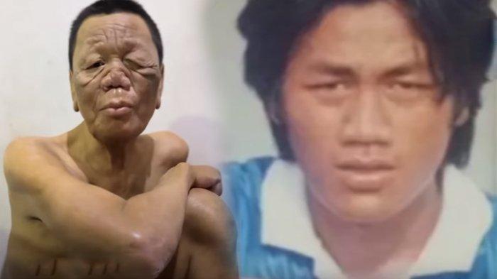 Nasib Pilu Budiono Mantan Pemain PSIS Semarang Hidup Miskin dan Hidungnya Pecah, Anak Jadi Pemulung