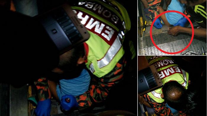 Ya Ampun, Kemaluan Bocah 3 Tahun Terjepit di Eskalator Selama 50 Menit!