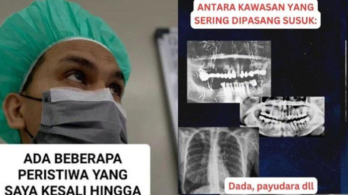 Curhat-Dokter-Syok-Temukan-Susuk-di-Tubuh-Wanita-Lumpuh-Semua-Terungkap-Saat-Minta-Foto-Rontgen.jpg