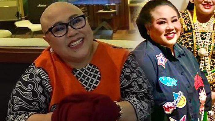 Curhat Nunung Masih Jadi Tulang Punggung Keluarga Meski Kanker dan Kemoterapi, Ikhlas Banting Tulang