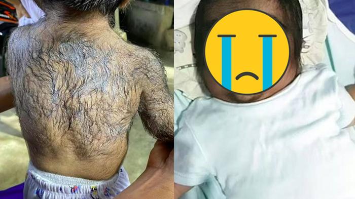 Kisah Anak Lahir Bak Manusia Serigala, Sang Ibu Curhat Kena Kutukan Dulu Makan Kucing Saat Hamil