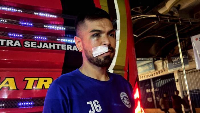 Kondisi-pemain-Arema-FC-Julian-Guevara-pasca-cedera-saat-melawan-Dewa-United.jpg