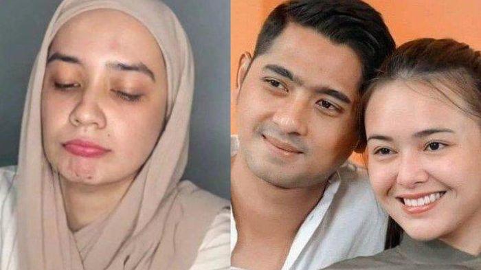 Curhat Putri Anne Singgung Soal Sakit Hati, Imbas Arya Saloka Kembali Mesra dengan Amanda Manopo?