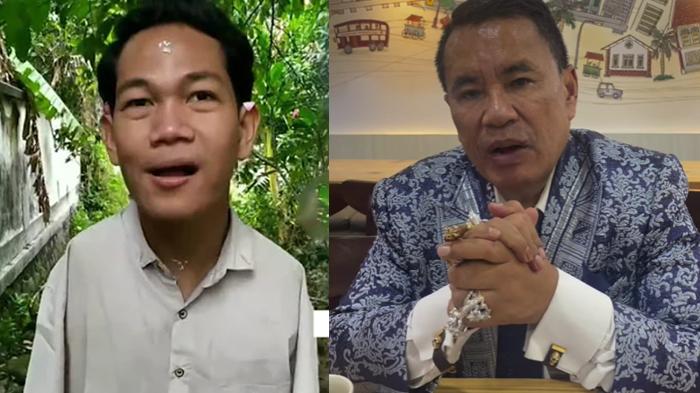 Reaksi Hotman Paris Gak Masuk Akal Agus Tersangka Disabilitas Tanpa Tangan Menodai Mahasiswi 'Aneh'