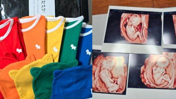 Rejeki Nomprok Pasutri Mendadak Kaya Usai Punya Bayi Kembar 5, Dapat Tabungan Rp 2 M dari Pemerintah