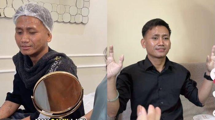 Rejeki Pegi Hidup Bak Artis Usai Bebas dari Kasus Vina Cirebon, Sampai Dapat Endorse Perawatan Wajah