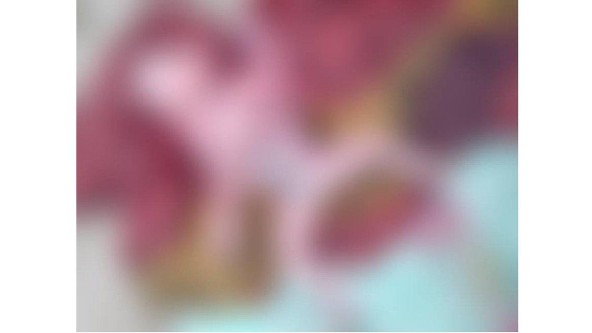 Tim Dokter Ketakutan Bantu Lahiran Bayi dengan 2 Wajah dan 8 Anggota Badan, Ayah Anggap Keajaiban