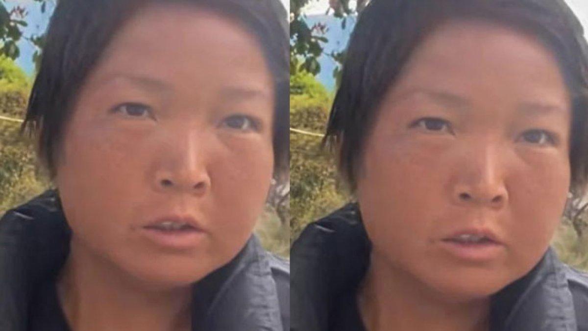 Gara-gara Kebiasaan Kerja, Wanita yang Usianya Masih Muda Ini Malah Terlihat Tua