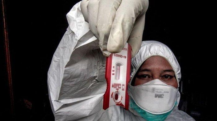 Pemkot Malang Terima 420 Alat Rapid Test Dari Pemprov Jatim, Bantu Tenaga Medis Tangkal Corona