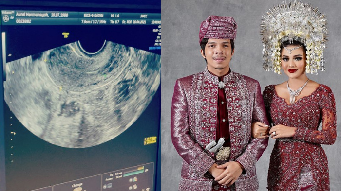 atta-ngebet-minta-aurel-segera-hamil-tak-puas-hasil-testpack-langsung-periksa-ke-dokter-kandungan.jpg