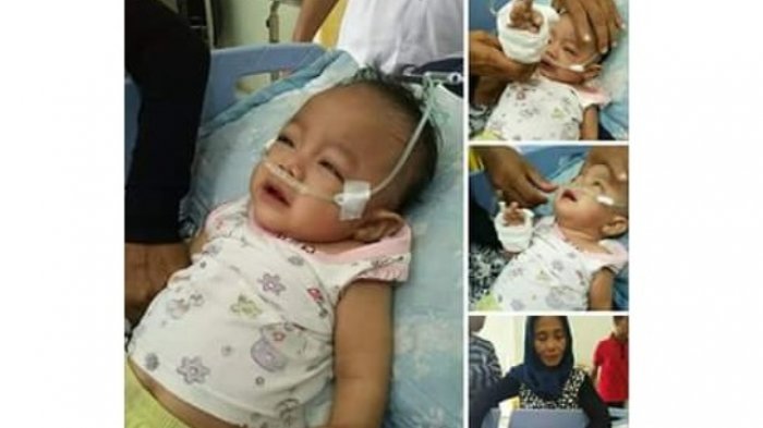 bayi-11-bulan-penderita-gizi-buruk-asal-aceh-ditinggal-ibunya_20171221_215604.jpg