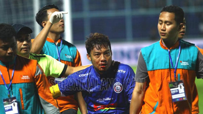 berita-arema-berdarah-kapten-arema-fc-hamka-hamzah-ngalam-malang.jpg