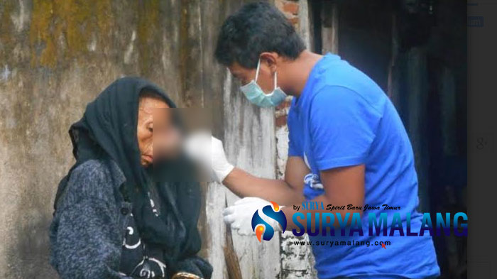 Memprihatinkan, Akibat Tumor di Wajahnya, Warga Miskin Asal Nganjuk Ini Sulit Beraktivitas