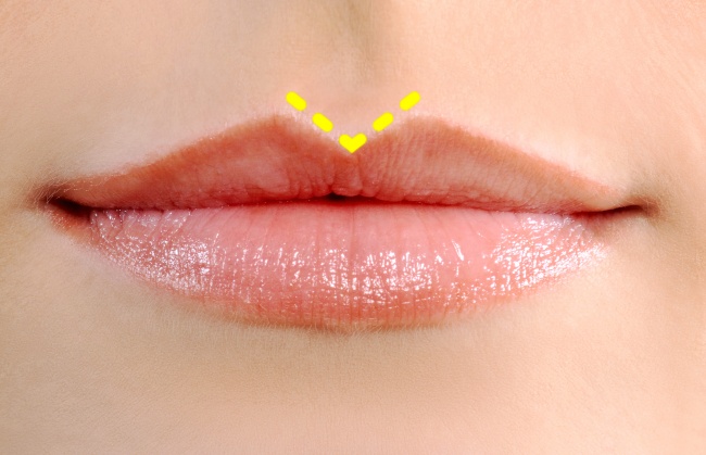 bibir-dengan-philtrum-tajam.jpg