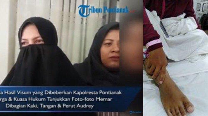 UPDATE Kondisi Audrey Pontianak Usai Keluar RS, Kuasa Hukum Ungkap Upaya Melukai Organ Intim
