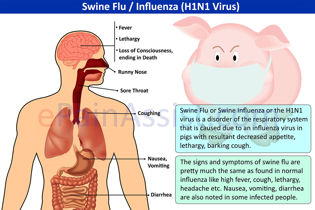 flu-babi-istilah-lainnya-swine-flu-atau-swine-influenza-h1n1-virus.jpg
