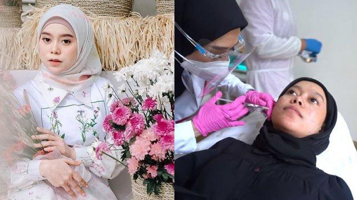 lesti-kejora-rela-tahan-sakit-saat-perawatan-suntik-rahang-dilakukan-agar-tirus-jelang-pernikahan.jpg