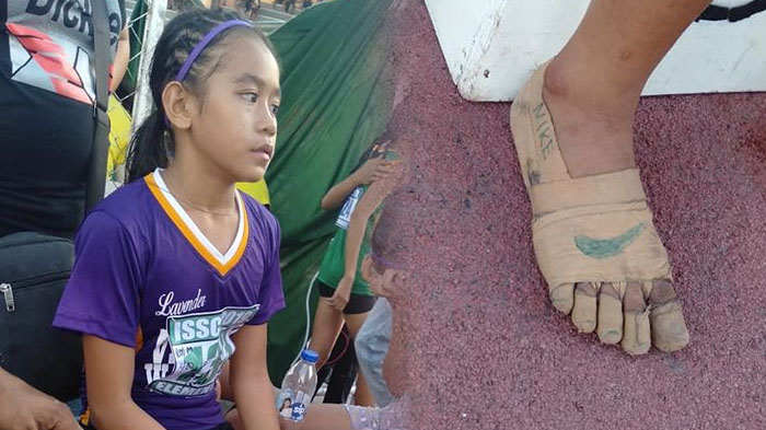 mengharukan-atlet-lari-anak-lomba-pakai-sepatu-berbahan-perban-bedah-1.jpg