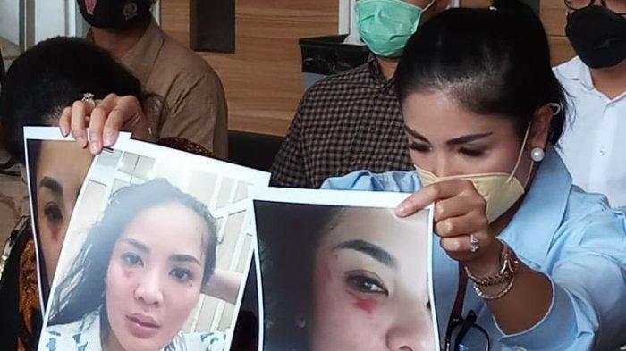 Nindy Ayunda Beberkan Kisah Pilunya, Luka Lebam karena KDRT, Hingga Diselingkuhi sejak Tahun 2015