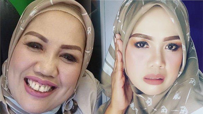pamer-hasil-oplas-di-instagram-elly-sugigi-girang-hasil-permak-sukses.jpg