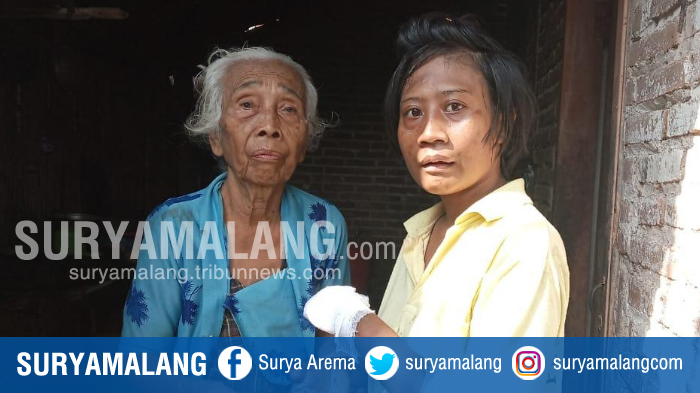 KISAH VIRAL Wanita Kanibal Kediri yang Memakan Jarinya Sendiri, Kini Dirawat di RSJ Menur Surabaya