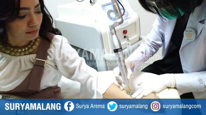 Teknologi Pico Laser Mampu Hilangkan All Color Tattoo