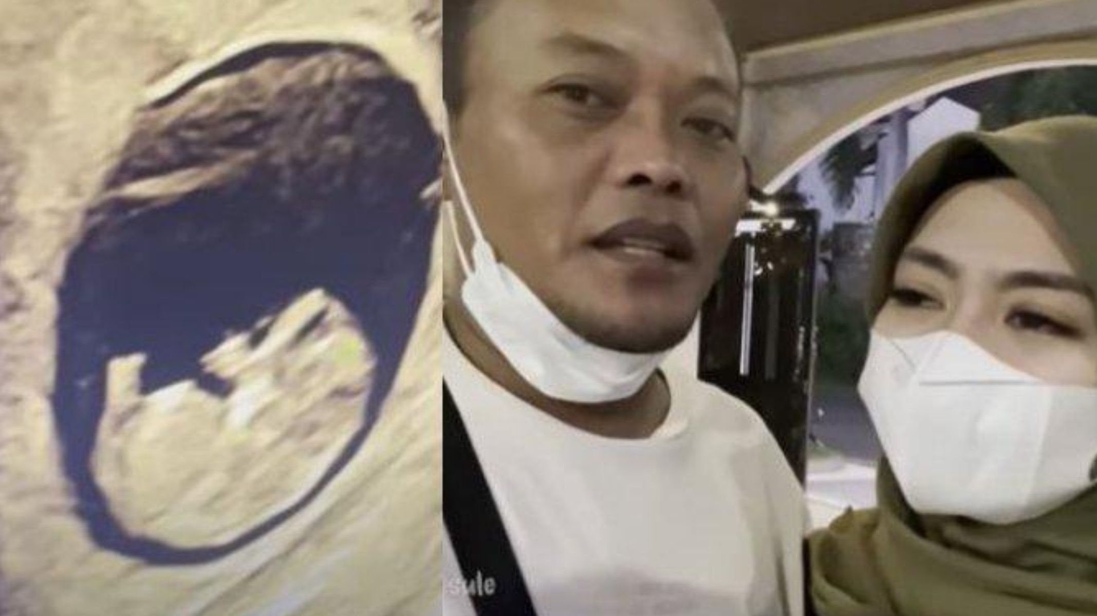 Tangis Nathalie Holscher Saat Lihat Kondisi Janinnya Jadi Sorotan, Sule Cuma Bisa Mohon Doa