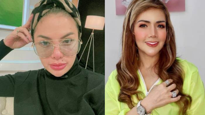 Operasi Plastik Nikita Mirzani vs Barbie Kumalasari Dikomen Para Artis Tak Presisi, Nyai Bereaksi