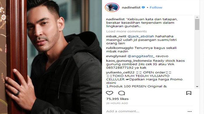 Robby Purba Kena 'Skak Mat' Saat Komentari Foto Nadine, Netter Todong Dia Dengan Balasan Ini