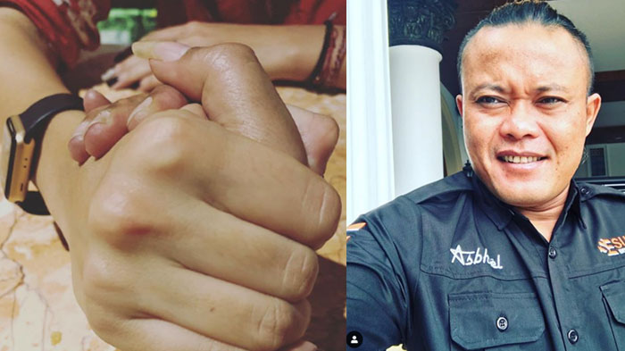 Foto Sule Genggam Tangan Wanita Tersebar, Ada Kabar Bahagia di Pengakuannya, Sebut Rencana Menikah