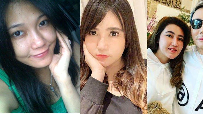 transformasi-wajah-via-vallen-dari-penyanyi-orkes-hingga-terkenal-bulat-sampai-tirus-tak-dikenali.jpg