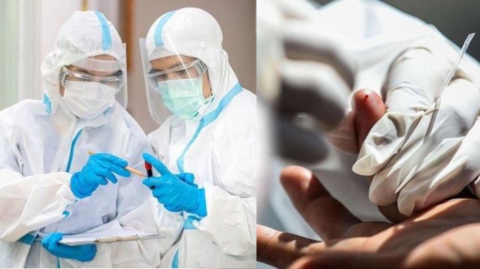 UPDATE Virus Corona Malang Hari Ini 10 Agustus 2020: 1649 Positif Covid-19 & 25330 di Jawa Timur