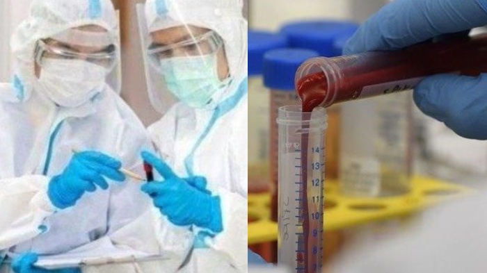 UPDATE Virus Corona di Malang 30 Agustus 2020: 2260 Positif Covid-19 & Pasien Sembuh Tembus 1534