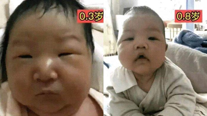 Waktu Kecil Diejek Jelek dan Gendut, Setelah Berusia 18 Tahun  Berubah Jadi Cantik Jelita