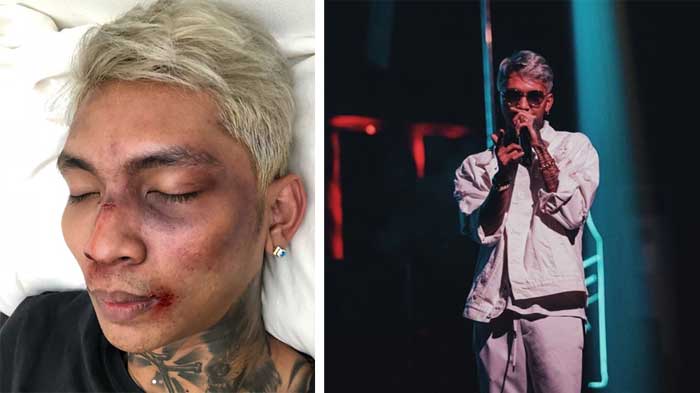 Simak Pengakuan MUA yang ‘Hajar’ Wajah Young Lex Hingga Babak Belur