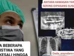 Curhat-Dokter-Syok-Temukan-Susuk-di-Tubuh-Wanita-Lumpuh-Semua-Terungkap-Saat-Minta-Foto-Rontgen.jpg