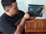 viral-cabut-gigi-meninggal-Ngawi.jpg