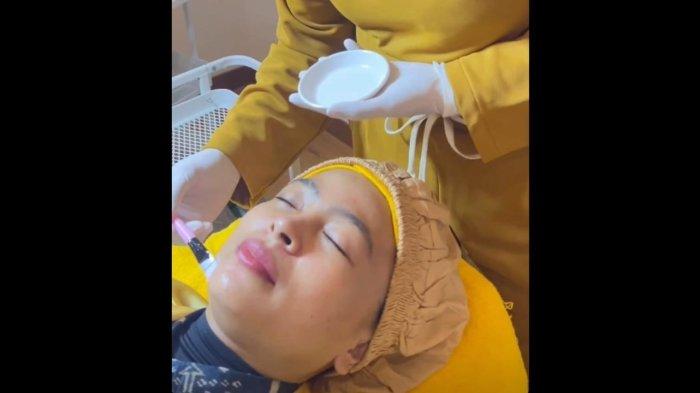 Klinik Estetika Ini Hadirkan Perawatan Atasi Kulit Bopeng Hingga Kerutan dan Flek Hitam