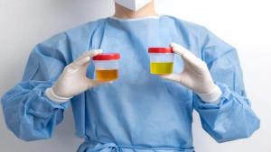 TES-URINE5.jpg