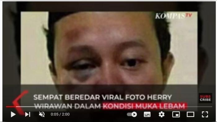 VIRAL Foto Wajah Guru yang Rudapaksa Santriwati, Babak Belur, Karutan Klas I Bandung Beri Penjelasan