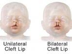 Bibir-sumbing1101.jpg