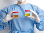 TES-URINE5.jpg