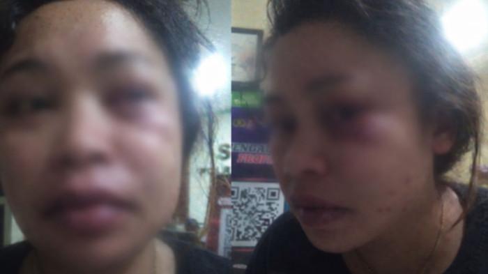 PENGANIAYAAN - Seorang perempuan di Kelurahan Marikurubu, Kecamatan Kota Ternate Tengah, Kota Ternate atas nama Nona H. Surabaya 26 tahun diduga jadi korban penganiayaan. Korban langsung lapor ke Polres Ternate, Kamis (12/3/2026).