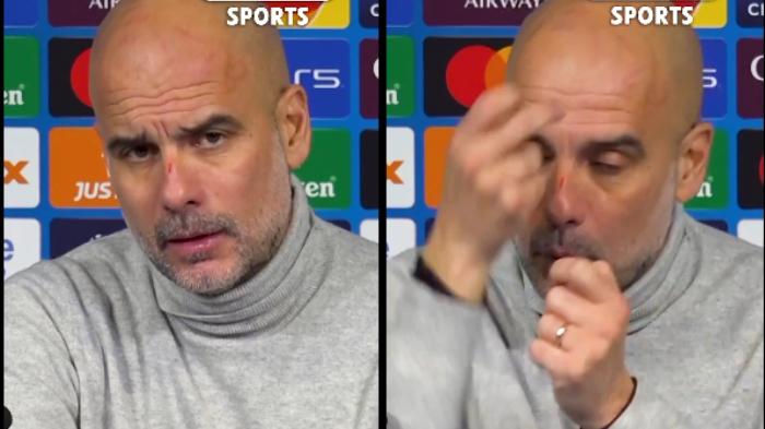 Pelatih-Manchester-City-Pep-Guardiola-mengalami-luka-di-hidung.jpg