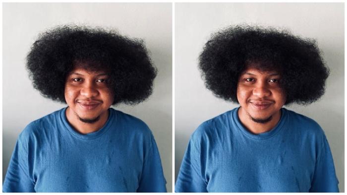 Babe Cabita Didiagnosis Anemia Aplastik, Berawal dari Gejala DBD, Kini Berobat ke Luar Negeri