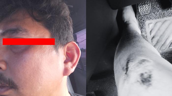 Sopir Taksi Online di Ternate Diduga Dipukul Saat Hendak Jemput Penumpang