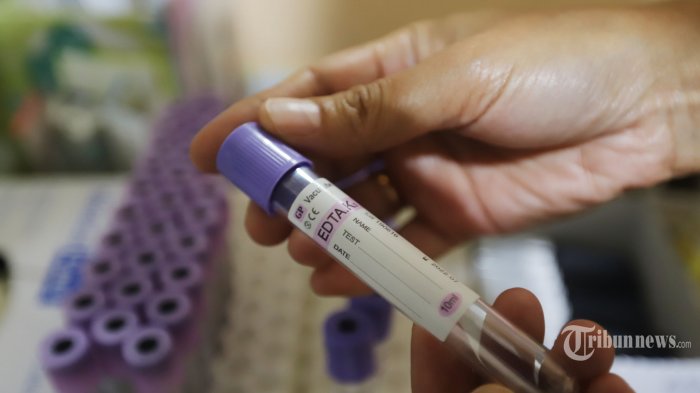 Peneliti Sebut Golongan Darah A Lebih Rentan Terinfeksi Virus Corona, Sedangkan O Kebal